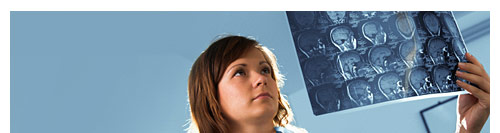 Lawyer For Traumatic Brain Injury Claims